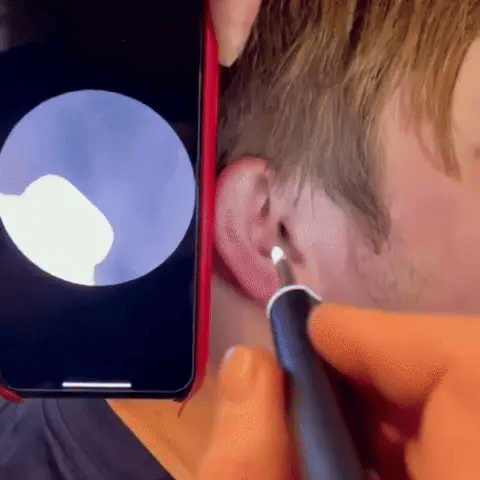 EasyView Ear Cleaner Pro